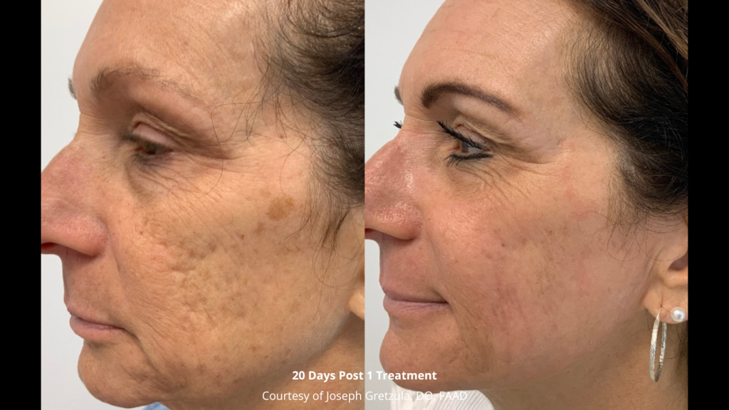 BeforeAfters-Website-18