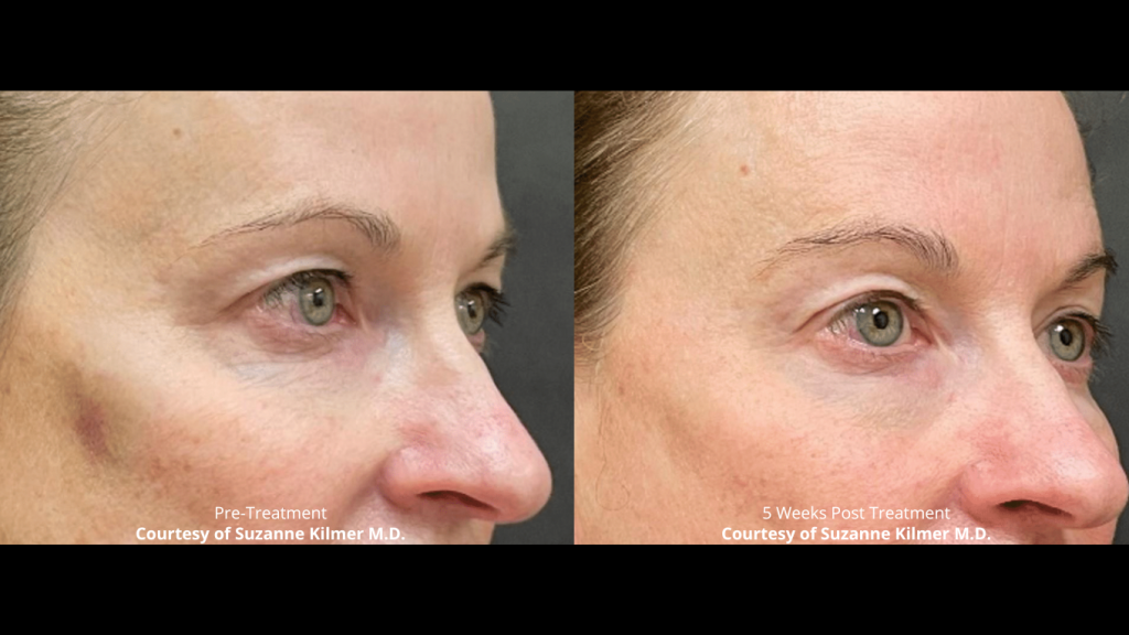 BeforeAfters-Website-9