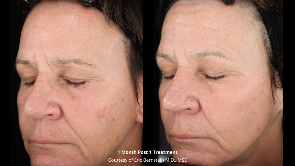 Green-Testimonial-Instagram-Post-300-×-300-px-1360-×-765-px-10-1