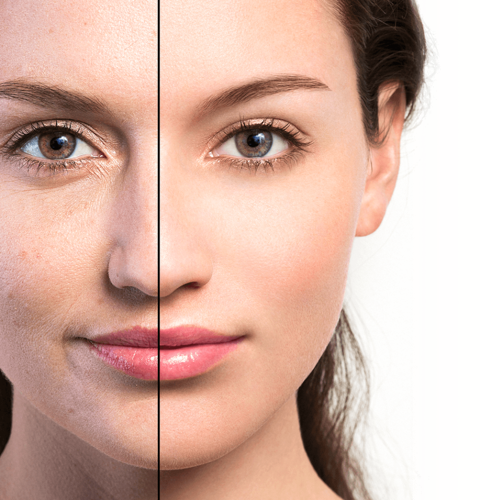 ultraclear prima e dopo